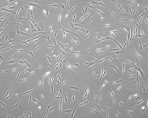 Mesenchymal Stem Cells culture